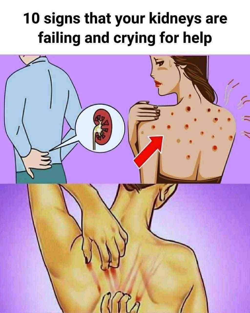 10 Early Signs Your Kidneys May Need Medical Attention