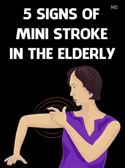 Early Warning Signs of a Mini-Stroke in Older Adults to Be Aware Of