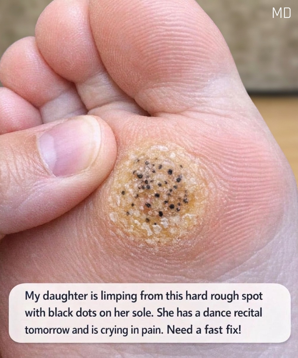 A Painful Foot Spot Before My Daughter’s Dance Recital: Looking for Safe Relief