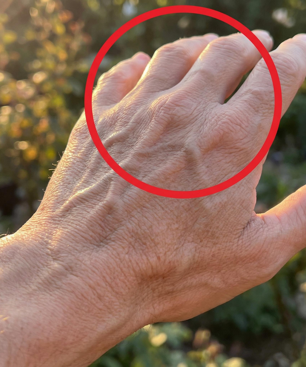 What Changes in Your Hand Veins Could Mean for Your Overall Health