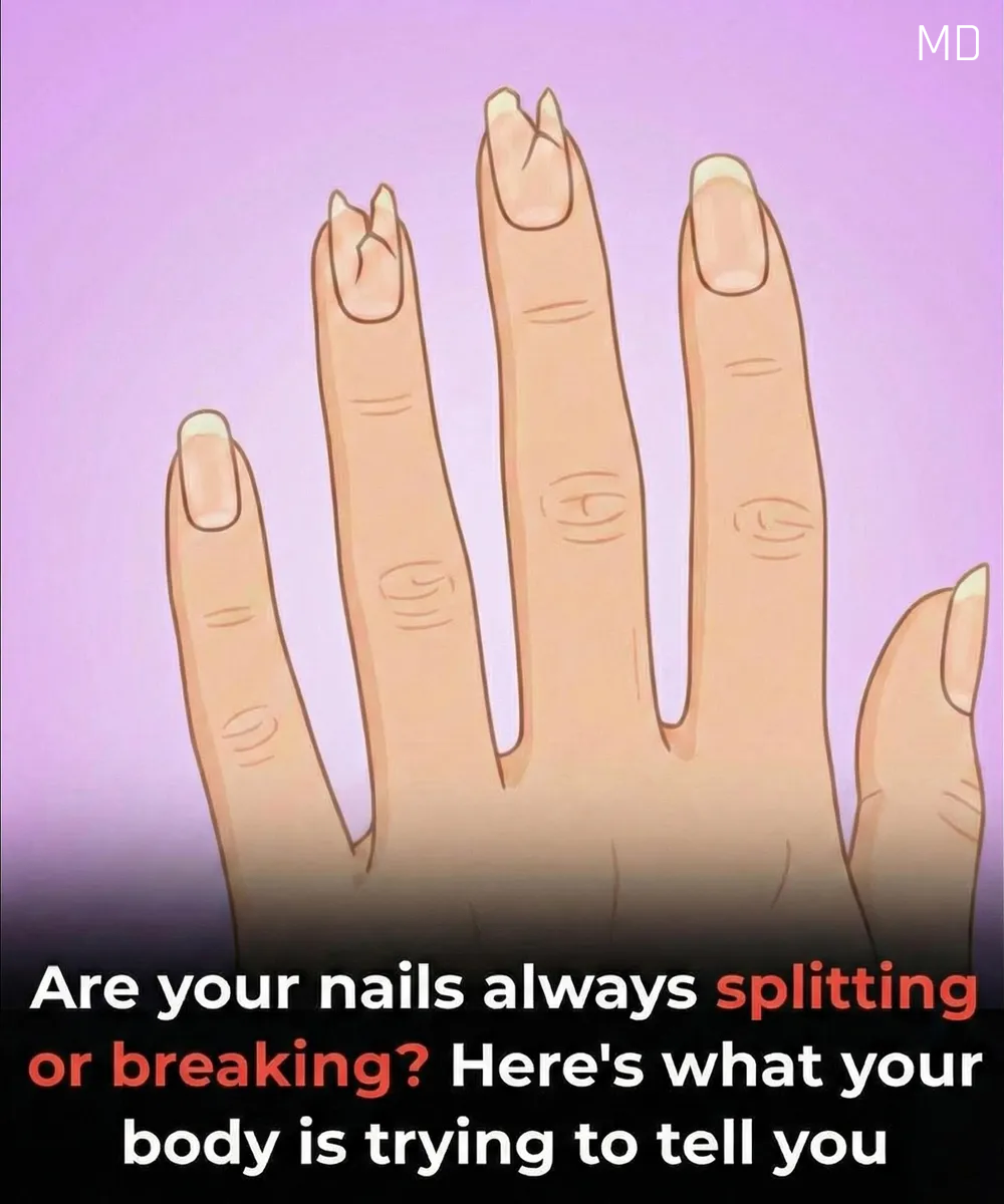Signs Your Nails May Be Hinting at a Health Issue