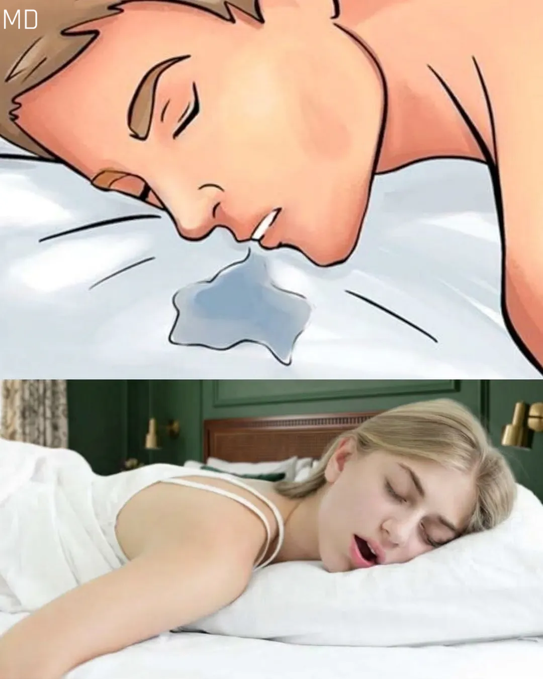 Understanding Why Drooling Can Occur During Sleep